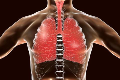 Zoom sur poumons pour lutte contre la tuberculose